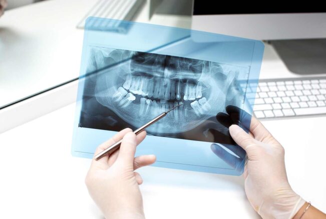dentist-analyzes-x-ray-photo