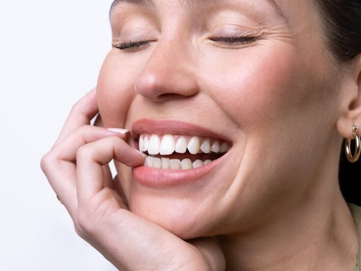 Bright natural smile after professional teeth whitening