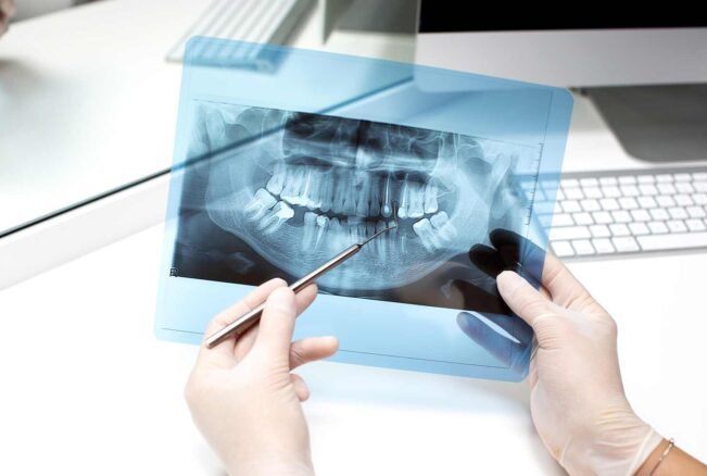 dentist-analyzes-x-ray-photo
